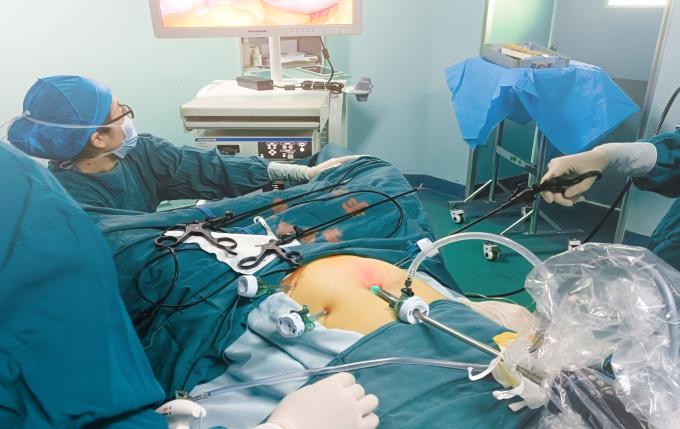 الـ " تـروكـار " البصري القابل للتعقيم والـ " كانولا " للـ " لابروسكوبـي " جراحة المريض الواحد 6