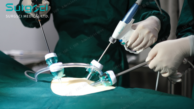 آخر أخبار الشركة أماكن شق المبازل | سورج 0