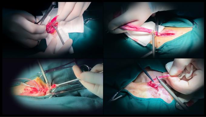 جراحة المنظار بالموجات فوق الصوتية نظام مشرط الإرقاء للاستخدام البيطري 6